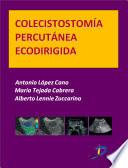 Libro Colecistostomía percutánea ecodirigida
