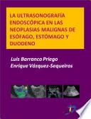 Libro La ultrasonografía endoscópica en las neoplasias malignas de esófago, estómago y duodeno