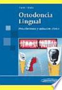 Libro Ortodoncia Lingual/ Lingual Orthodontics